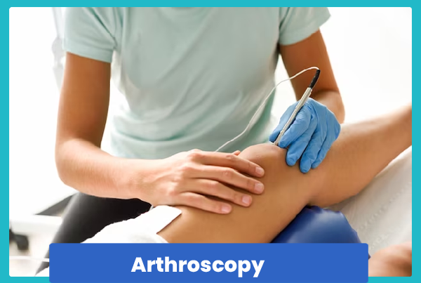 Arthroscopy