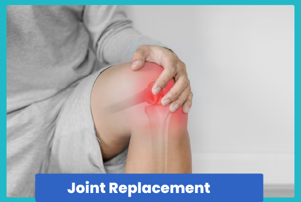 Joint Replacement