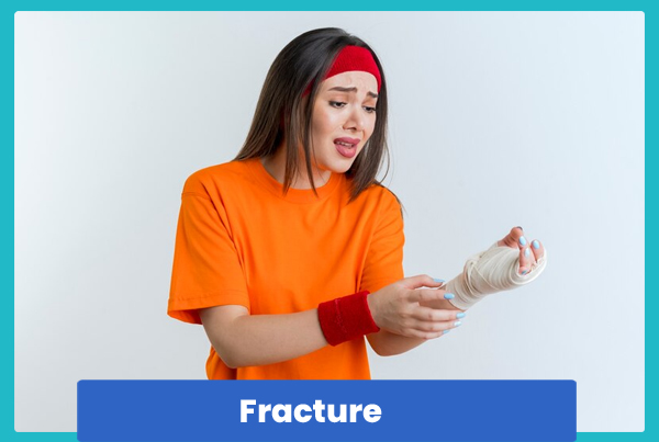 Fracture
