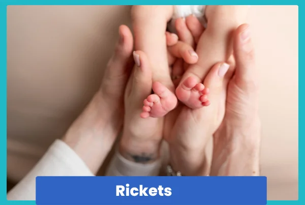 Rickets